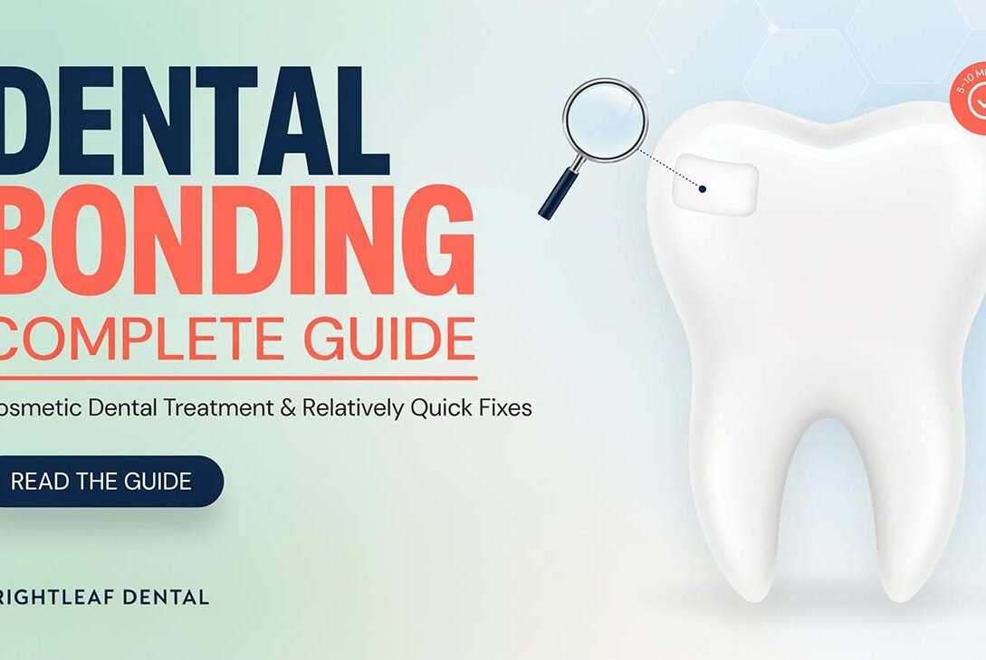 Dental Bonding Complete Guide: Cosmetic Dental Treatment & Relatively Quick Fixes