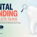 Dental Bonding Complete Guide: Cosmetic Dental Treatment & Relatively Quick Fixes
