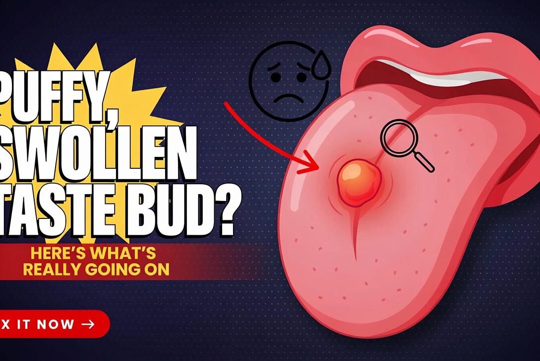 Puffy, Swollen Taste Bud? Here's What's Really Going On (and How to Fix It)