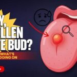 Puffy, Swollen Taste Bud? Here's What's Really Going On (and How to Fix It)