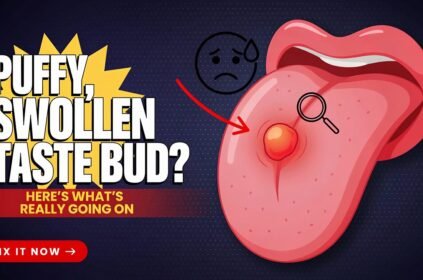 Puffy, Swollen Taste Bud? Here's What's Really Going On (and How to Fix It)