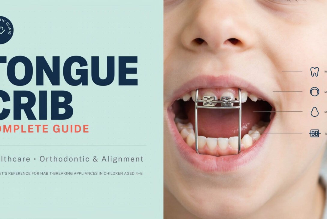 Tongue Crib Complete Guide: Healthcare, Orthodontic & Alignment