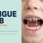 Tongue Crib Complete Guide: Healthcare, Orthodontic & Alignment
