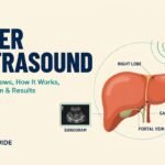 Liver Ultrasound: What It Shows, How It Works, Preparation & Results