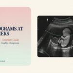 Sonograms at 13 Weeks Pregnant Complete Guide: Ultrasound, Health & Diagnosis