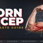 Torn Bicep: Complete Guide to Symptoms, Causes, Treatment & Recovery