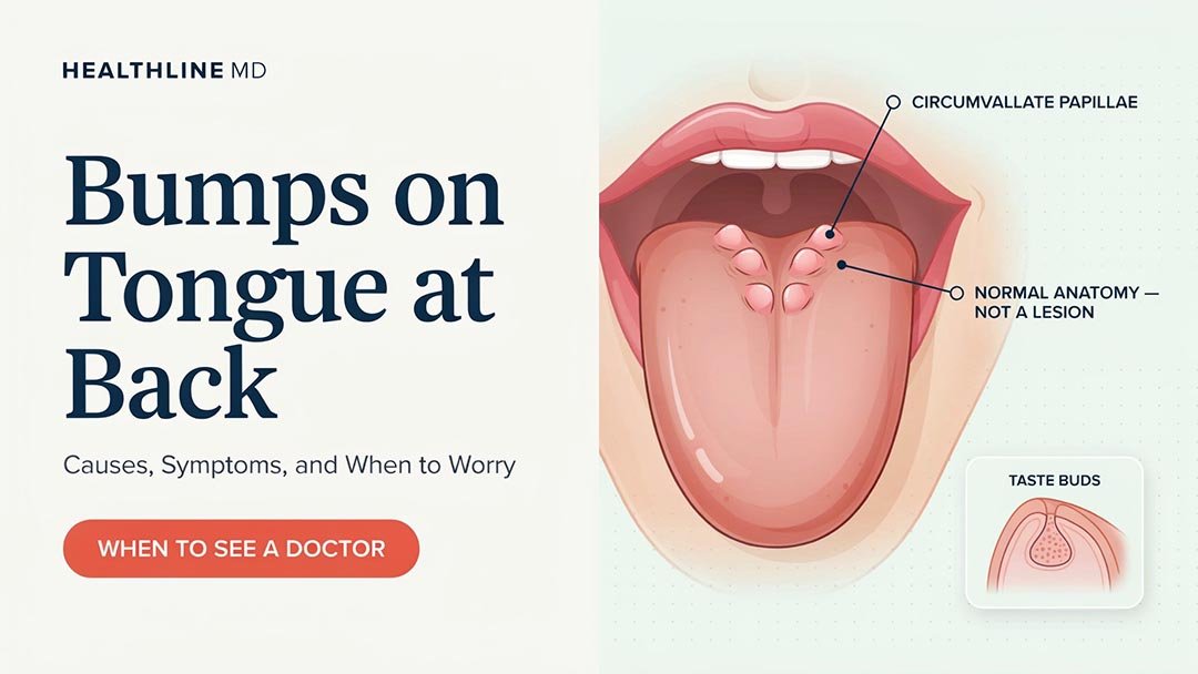 Bumps on Tongue at Back: Causes, Symptoms, and When to Worry