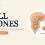 Gall Stones: Symptoms, Causes, and Treatment Options Explained