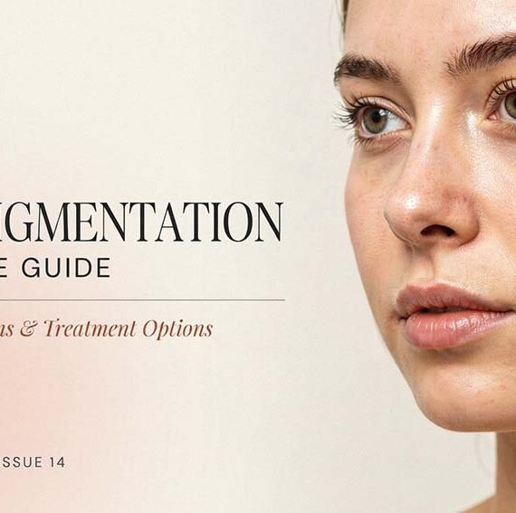 Overpigmentation Complete Guide: Causes, Symptoms & Treatment Options