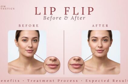 Lip Flip Before and After: Benefits, Treatment Process, and Expected Results